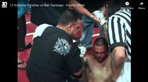 Anthony Ornellas vs Ben Santiago